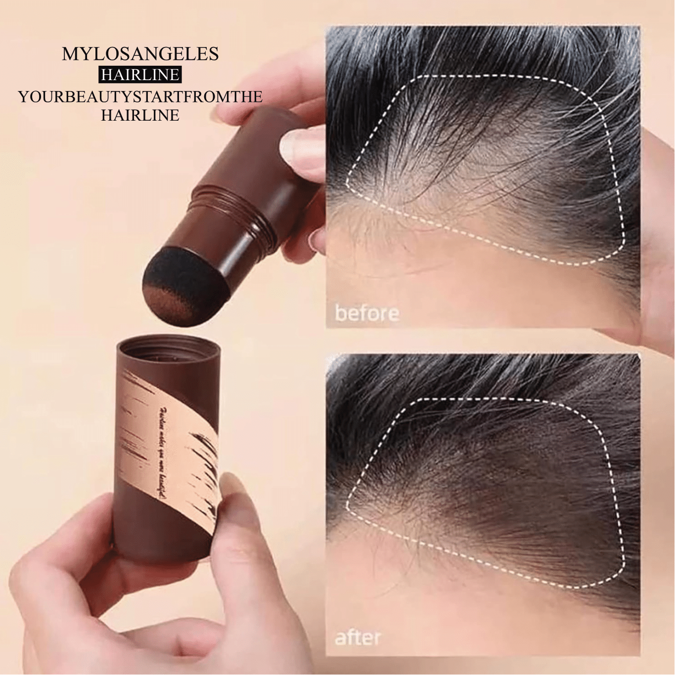 MyLosAngeles 2 in 1 Hairline